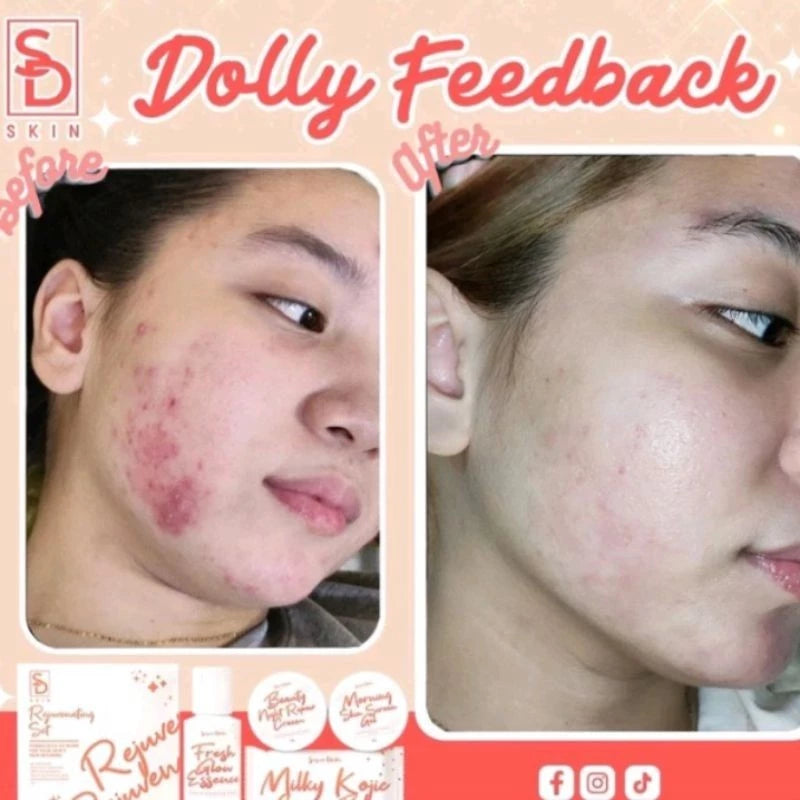 Sugar Dolls Rejuvenating Set (New Packaging) Micropeeling Set and Anti Acne Set Glass Skin