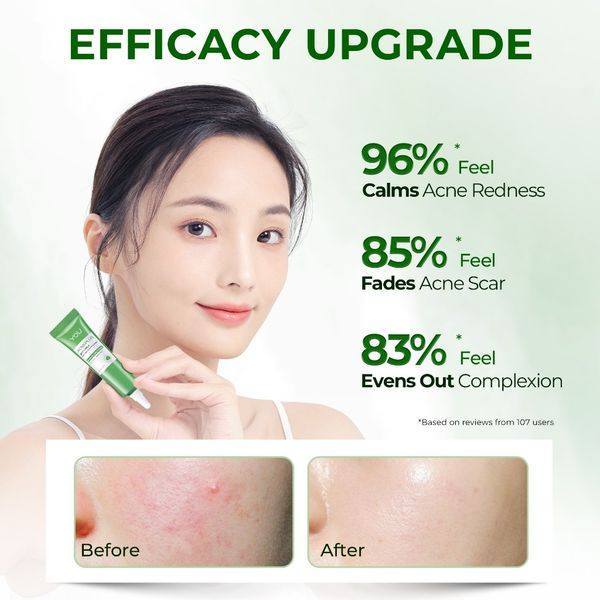 Y.O.U Acne Plus Spot Care X 15g